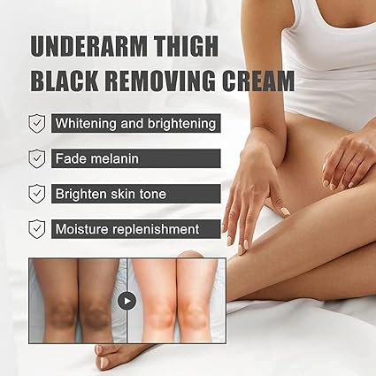 Dark Spot Remover Cream